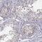 GST antibody, NBP2-49118, Novus Biologicals, Immunohistochemistry paraffin image 