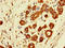 Syndecan Binding Protein 2 antibody, LS-C379571, Lifespan Biosciences, Immunohistochemistry paraffin image 