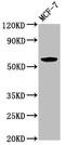 Immunoglobulin Like Domain Containing Receptor 1 antibody, CSB-PA768201LA01HU, Cusabio, Western Blot image 