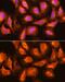 SEC11 Homolog A, Signal Peptidase Complex Subunit antibody, GTX66062, GeneTex, Immunofluorescence image 