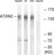 Sca2 antibody, LS-C119747, Lifespan Biosciences, Western Blot image 