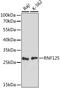 Ring Finger Protein 125 antibody, 15-910, ProSci, Western Blot image 