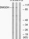 Dimethylglycine Dehydrogenase antibody, TA315405, Origene, Western Blot image 