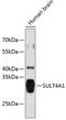 SULT4A1 antibody, 23-739, ProSci, Western Blot image 