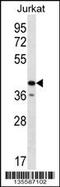 Golgi reassembly-stacking protein 2 antibody, 58-319, ProSci, Western Blot image 