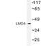 LIM Domain Only 4 antibody, LS-C176787, Lifespan Biosciences, Western Blot image 
