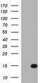 Microseminoprotein Beta antibody, TA803517AM, Origene, Western Blot image 