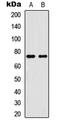 p65 antibody, LS-C358302, Lifespan Biosciences, Western Blot image 