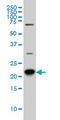 Mel antibody, LS-B10994, Lifespan Biosciences, Western Blot image 