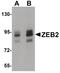 Zinc Finger E-Box Binding Homeobox 2 antibody, PA5-20980, Invitrogen Antibodies, Western Blot image 
