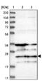 RING finger protein 114 antibody, PA5-54344, Invitrogen Antibodies, Western Blot image 