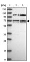 LIM Domain Kinase 1 antibody, NBP1-87721, Novus Biologicals, Western Blot image 