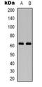 P21 (RAC1) Activated Kinase 2 antibody, orb338917, Biorbyt, Western Blot image 