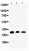 Aquaporin 1 (Colton Blood Group) antibody, PA1010, Boster Biological Technology, Western Blot image 