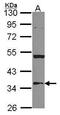 3-Hydroxy-3-Methylglutaryl-CoA Lyase antibody, PA5-30059, Invitrogen Antibodies, Western Blot image 