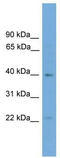 DMRT Like Family B With Proline Rich C-Terminal 1 antibody, TA331449, Origene, Western Blot image 