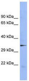 Double-stranded RNA-binding protein Staufen homolog 2 antibody, TA343809, Origene, Western Blot image 