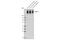 Sodium Voltage-Gated Channel Alpha Subunit 1 antibody, 18339S, Cell Signaling Technology, Western Blot image 
