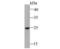 Lysophospholipase 1 antibody, NBP2-80466, Novus Biologicals, Western Blot image 