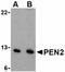 Presenilin Enhancer, Gamma-Secretase Subunit antibody, orb74776, Biorbyt, Western Blot image 