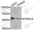 FLP-1 antibody, A8487, ABclonal Technology, Western Blot image 