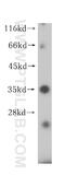Major Histocompatibility Complex, Class II, DR Beta 4 antibody, 15733-1-AP, Proteintech Group, Western Blot image 