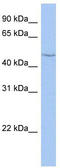 Cytochrome P450 Family 27 Subfamily C Member 1 antibody, TA336202, Origene, Western Blot image 
