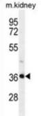 PIH1 Domain Containing 2 antibody, AP53303PU-N, Origene, Western Blot image 