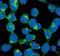 Fibroblast Growth Factor Receptor 3 antibody, MA5-14843, Invitrogen Antibodies, Immunofluorescence image 