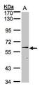 Steroid Sulfatase antibody, PA5-28259, Invitrogen Antibodies, Western Blot image 