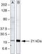 Ubiquitin Conjugating Enzyme E2 N antibody, 37-1100, Invitrogen Antibodies, Western Blot image 