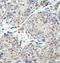 Four And A Half LIM Domains 1 antibody, orb78468, Biorbyt, Immunohistochemistry paraffin image 