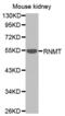 RNA Guanine-7 Methyltransferase antibody, abx001197, Abbexa, Western Blot image 