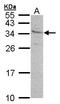 KIR antibody, LS-C185357, Lifespan Biosciences, Western Blot image 