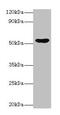 Epoxide Hydrolase 1 antibody, CSB-PA007734LA01HU, Cusabio, Western Blot image 