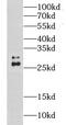 Caseinolytic Mitochondrial Matrix Peptidase Proteolytic Subunit antibody, FNab01772, FineTest, Western Blot image 