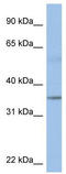 Potassium Channel Tetramerization Domain Containing 4 antibody, TA341717, Origene, Western Blot image 