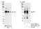 XPC Complex Subunit, DNA Damage Recognition And Repair Factor antibody, NB100-58801, Novus Biologicals, Western Blot image 