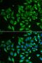 DHYS antibody, orb247394, Biorbyt, Immunofluorescence image 