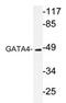 GATA Binding Protein 4 antibody, AP20231PU-N, Origene, Western Blot image 