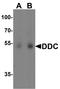 Dopa Decarboxylase antibody, A01374, Boster Biological Technology, Western Blot image 
