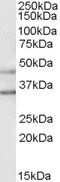 Potassium Voltage-Gated Channel Subfamily J Member 6 antibody, EB08036, Everest Biotech, Western Blot image 