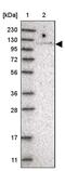 TBC1 Domain Family Member 2 antibody, PA5-56577, Invitrogen Antibodies, Western Blot image 