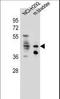 Growth Hormone Secretagogue Receptor antibody, LS-C166469, Lifespan Biosciences, Western Blot image 