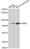 LIM domain kinase 2 antibody, A5409, ABclonal Technology, Western Blot image 