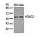 Histone Deacetylase 2 antibody, orb14545, Biorbyt, Western Blot image 