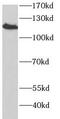 Selectin P Ligand antibody, FNab09941, FineTest, Western Blot image 
