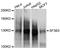 Splicing Factor 3b Subunit 3 antibody, A2304, ABclonal Technology, Western Blot image 