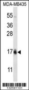 Histone Cluster 1 H2B Family Member I antibody, MBS9215123, MyBioSource, Western Blot image 
