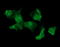 Musashi RNA Binding Protein 1 antibody, LS-C174757, Lifespan Biosciences, Immunofluorescence image 